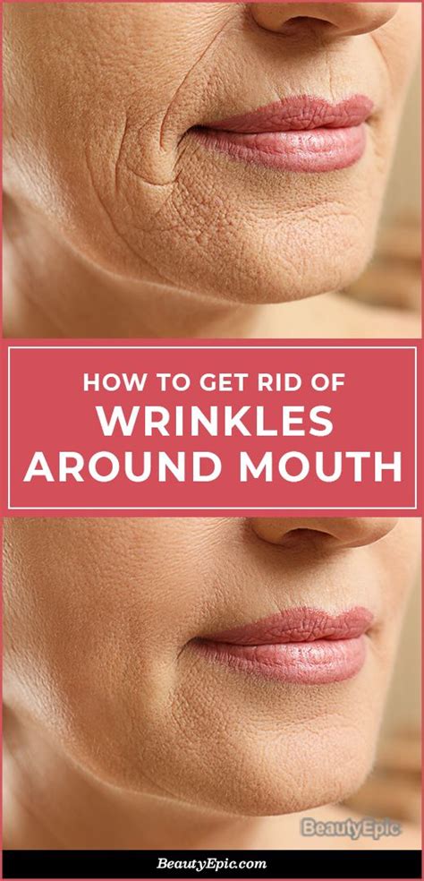 natural ways to get rid of wrinkles around mouth